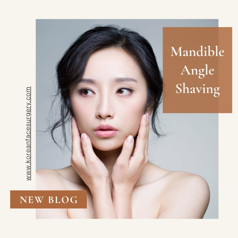 Mandible Angle Shaving