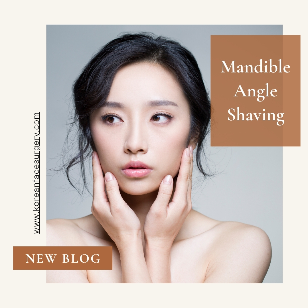 Mandible Angle Shaving