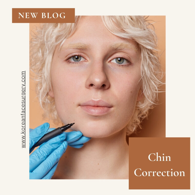 Chin Correction