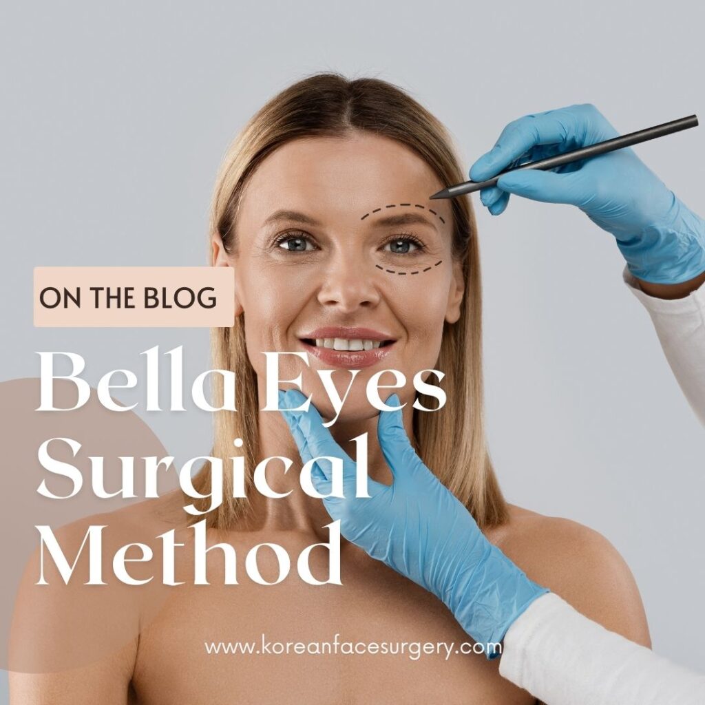 Bella Eyes Surgery Method