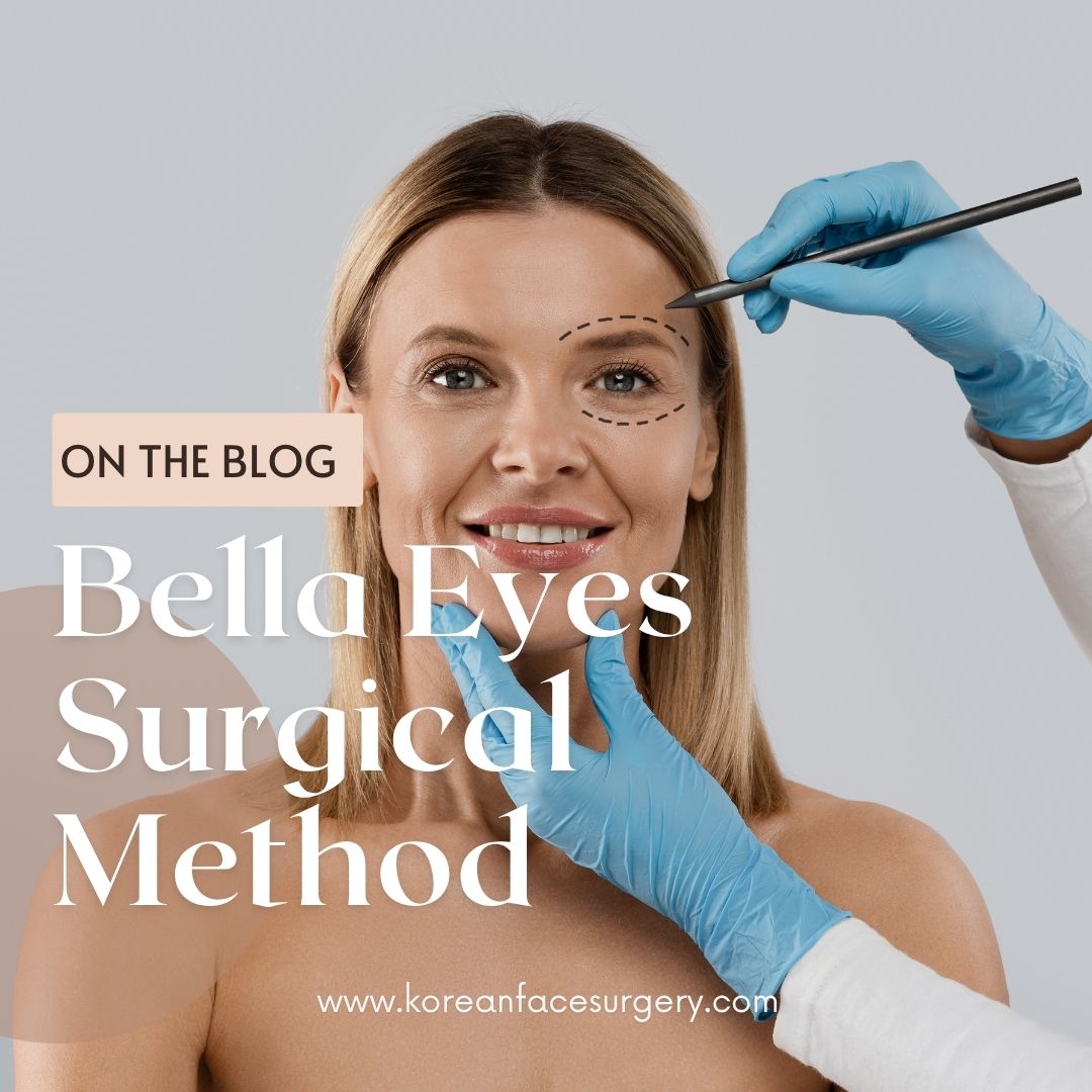 Bella Eyes Surgery Method
