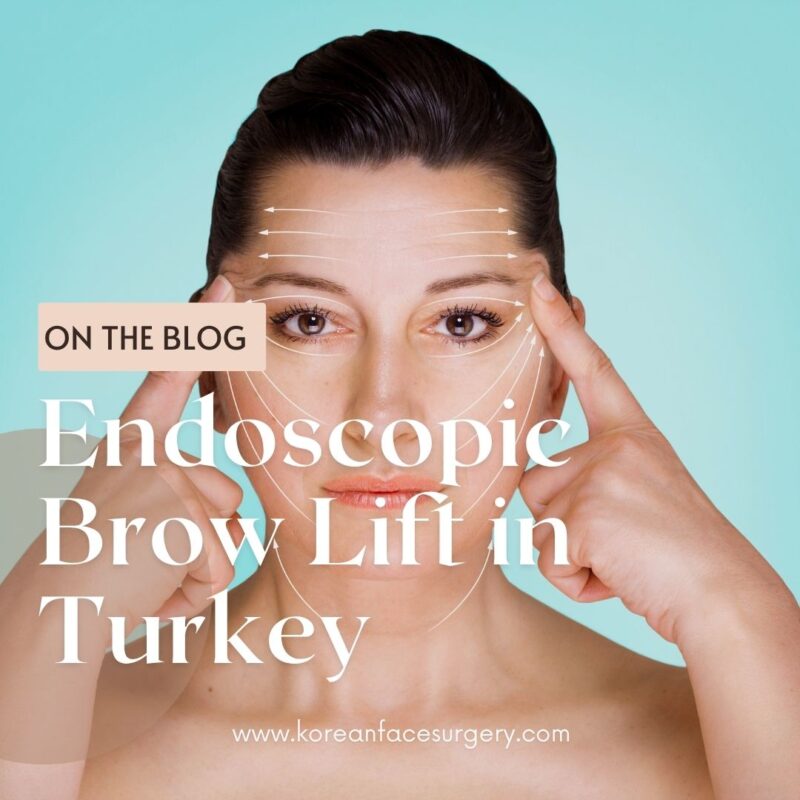 Endoscopic Brow Lift Turkey