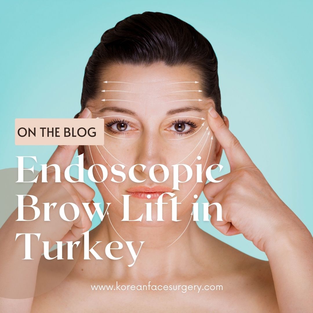 Endoscopic Brow Lift Turkey